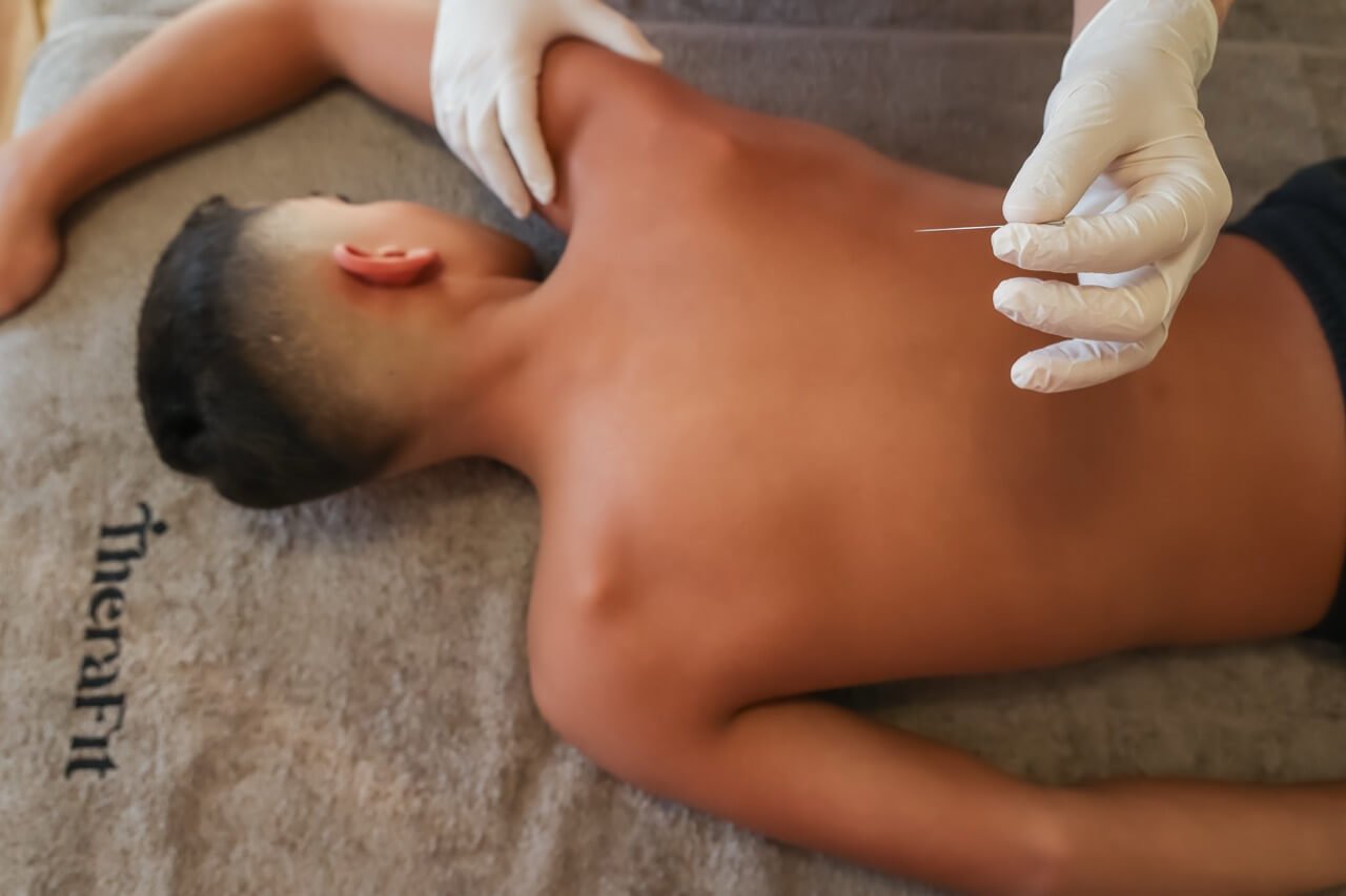 Βελονισμός από την Λασκαρίνα Λαβδά σε ασθενή